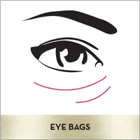 Eyes Eye Depuffing Roller for bags under eyes