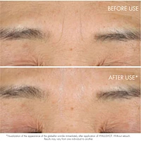 Capture Totale Hyalushot : Wrinkle Corrector with Hyaluronic Acid