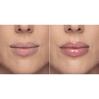 Lip Injection Extreme Plumper