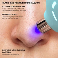 KIWI™ Blackhead Remover Pore Vacuum With Blue LED Light