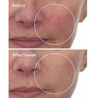 Cellular Hydration Barrier Repair Serum