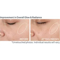 Advanced Resurfacing Pro Glowfoliant™ Mix-In Microderm Crystals