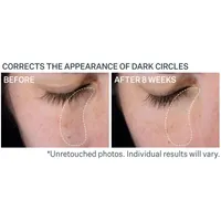 Super-C Dark Circle Brightening Eye Serum