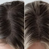 Refresh Topical Scalp Supplement