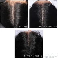 Flourish® Conditioner for Thinning hair