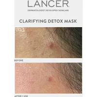 Clarifying Detox Mask with Green Tea