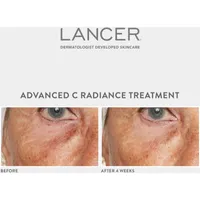 Advanced C Radiance Treatment
with Vitamin C Collagen Cofactor 10x