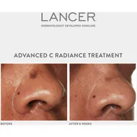 Advanced C Radiance Treatment
with Vitamin C Collagen Cofactor 10x