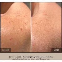 Resurfacing Body Toner