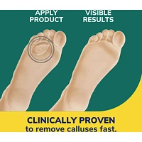 Dr. Scholl’s® Callus Removers with Duragel™ technology