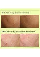 Mega-Mushroom Dark Spot Brightening Face Serum