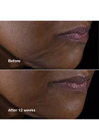 Smart Clinical Repair™ Lifting Face + Neck Cream