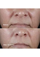 Smart Clinical Repair™ Wrinkle Correcting Rich Face Cream