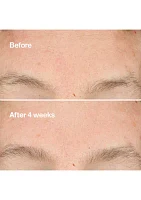 Clarifying Do-Over Peel