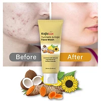 KojicLux Kojic Acid & Turmeric Face Wash Facial Cleanser (250mL)