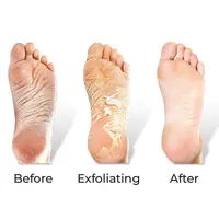 RevivaFoot Exfoliating Foot Peel Masks (2pk) | As Seen On Social!