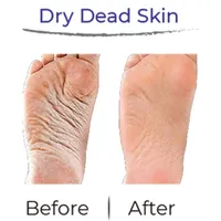 RevivaFoot Exfoliating Foot Peel Masks (2pk) | As Seen On Social!