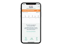 AliveCor Cordless KardiaMobile ECG Device - AC-009-UA-C