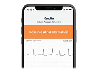 AliveCor KardiaMobile 6L Mobile ECG Device - AC-019-NUA-A