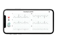 AliveCor KardiaMobile 6L Mobile ECG Device - AC-019-NUA-A