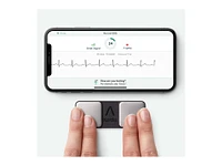 AliveCor Cordless KardiaMobile ECG Device - AC-009-UA-C