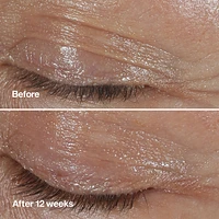 Smart Clinical Repair Wrinkle Correcting Eye Cream