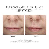 HA5 Smooth and Plump Lip System