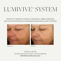 Lumivive System, Day and Night