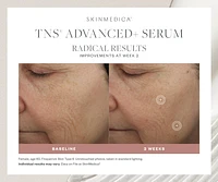 TNS Advanced+ Serum