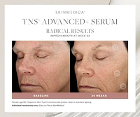 TNS Advanced+ Serum