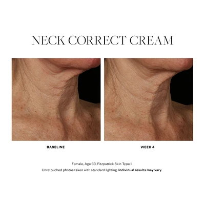 Neck Correct Cream