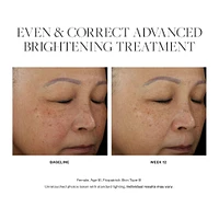 Even & Correct Advanced Brightening Treatment