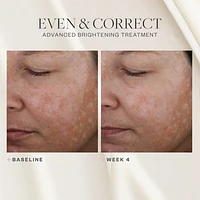 Even & Correct Advanced Brightening Treatment