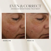 Even & Correct Advanced Brightening Treatment