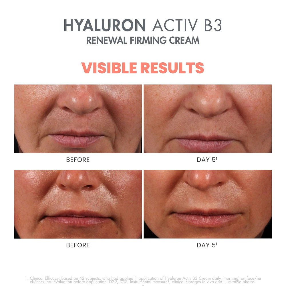 Hyaluron Activ B3 Renewal Firming Cream