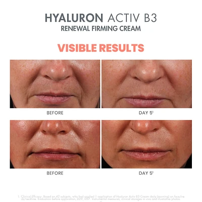 Hyaluron Activ B3 Renewal Firming Cream