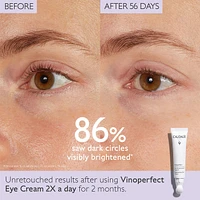 Vinoperfect Dark Circle Brightening Eye Cream