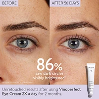 Vinoperfect Dark Circle Brightening Eye Cream