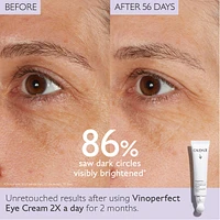 Vinoperfect Dark Circle Brightening Eye Cream