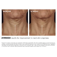 Tripeptide-R Neck Repair