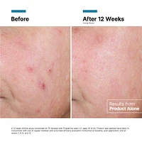 Advanced RGN-6 Regenerative Cream