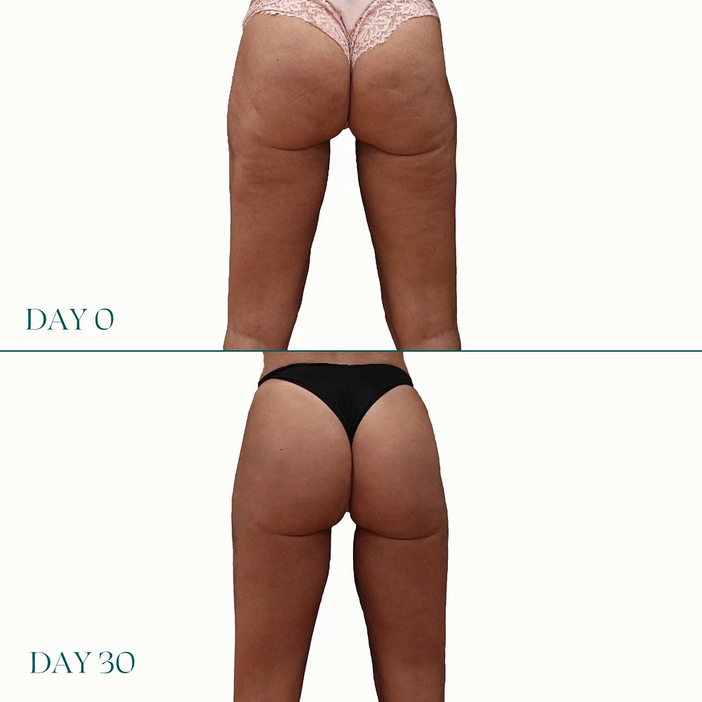Peach-Lite Super Lift for The Derriere