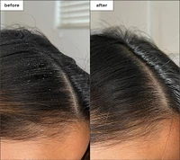 Scalp Revival Charcoal and Tea Tree Buildup Detox Spray