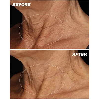 Neck Fit Contour Serum