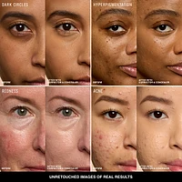 Under Eye Corrector