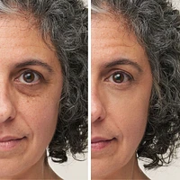 Enlighten Plus Under-Eye Concealer