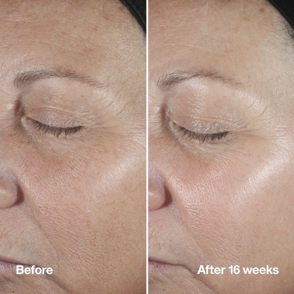 Smart Clinical Repair™ Wrinkle Correcting Serum