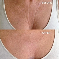 Wrinkles Schminkles Chest Patch