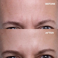 Wrinkles Schminkles Forehead Patches