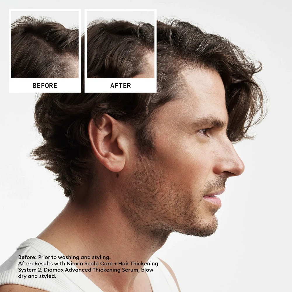NIOXIN - SYSTÈME | 2 Cheveux Naturels Chute Avancée | KIT | Trousse d'Essaie